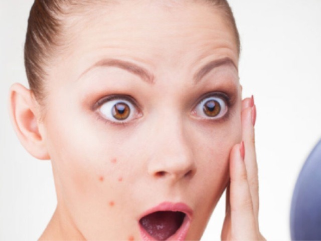 20 Secrets behind Stubborn Acne
