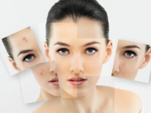 Get a Dermatological Makeover