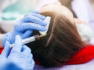 A Closer Look at QR678: The FDA-Approved Hair Loss Treatment in Bangalore